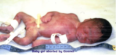 Gosnell trial